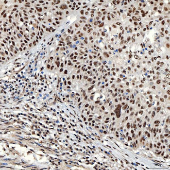 SNRNP40 Antibody