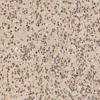 SNRNP40 Antibody