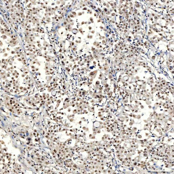 SNRNP40 Antibody