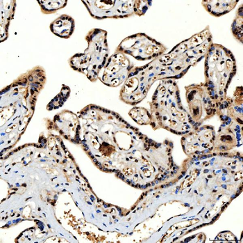 SNRNP40 Antibody
