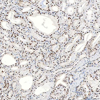 SNRNP40 Antibody