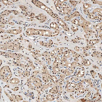 SNRNP40 Antibody