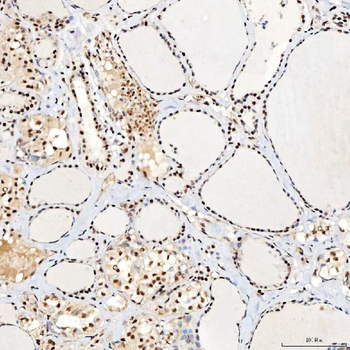 SNRNP40 Antibody
