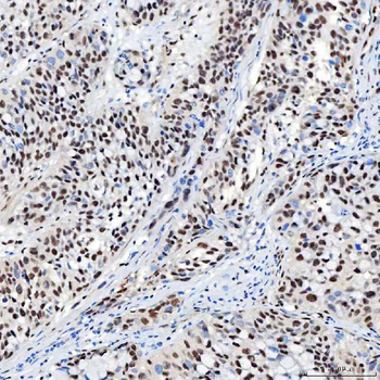 SNRNP40 Antibody