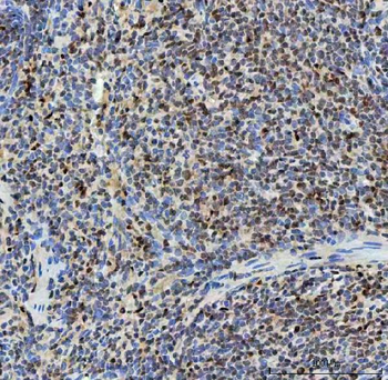SNRNP40 Antibody
