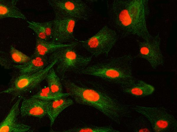 SNRNP40 Antibody