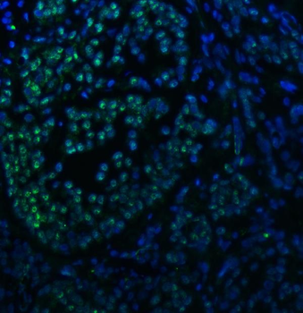 SNRNP40 Antibody
