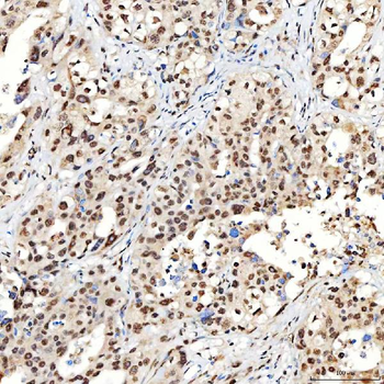 SNRNP40 Antibody