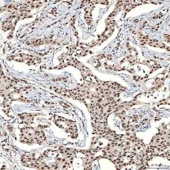SNRNP40 Antibody