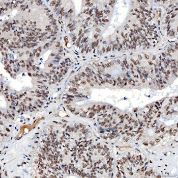 SNRNP40 Antibody