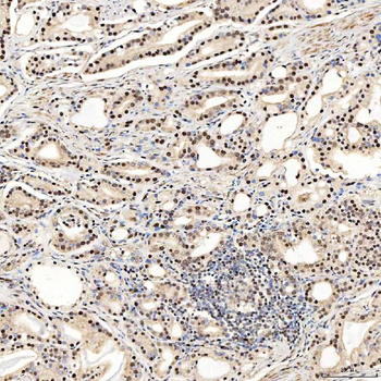 SNRNP27 Antibody