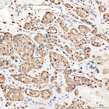 SNRNP27 Antibody