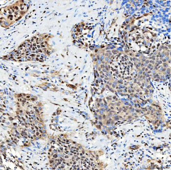 SNRNP27 Antibody