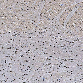 SNRNP27 Antibody