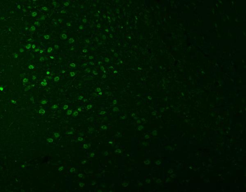 SNRNP27 Antibody