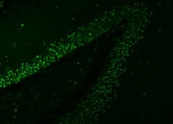 SNRNP27 Antibody