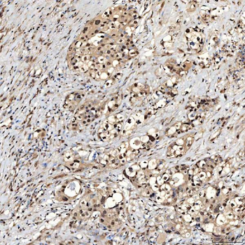 SNRNP27 Antibody