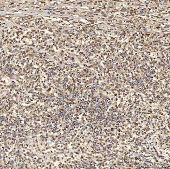 SNRNP27 Antibody