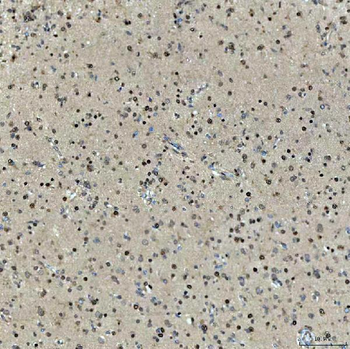 SNRNP27 Antibody