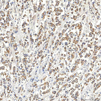 SNPH Rabbit Polyclonal Antibody