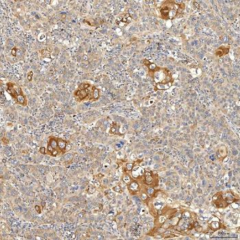SNPH Rabbit Polyclonal Antibody