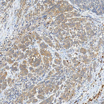 SNPH Rabbit Polyclonal Antibody