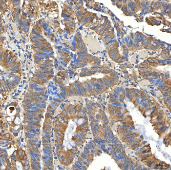 SNPH Rabbit Polyclonal Antibody