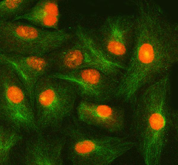 SMOX Antibody