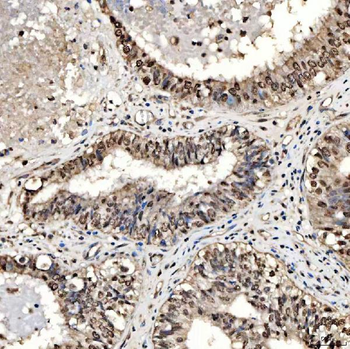 SMOX Antibody