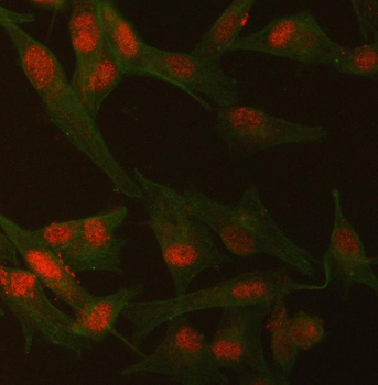 SMCHD1 Rabbit Polyclonal Antibody