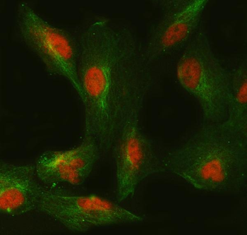 SMC6 Rabbit Polyclonal Antibody