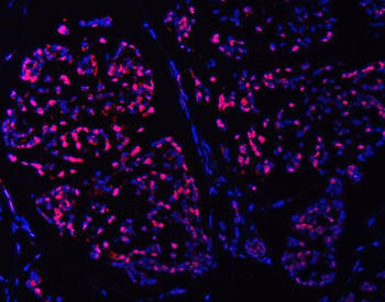 SMC6 Rabbit Polyclonal Antibody