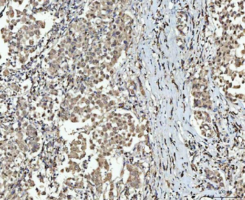 SMC6 Rabbit Polyclonal Antibody