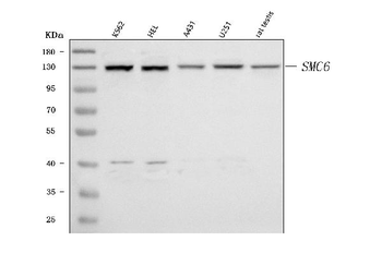 SMC6 Rabbit Polyclonal Antibody
