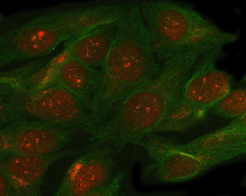 SMC5 Rabbit Polyclonal Antibody
