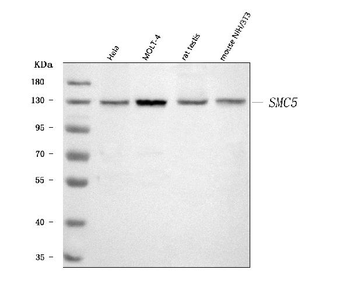 SMC5 Rabbit Polyclonal Antibody