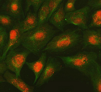 SMC2 Rabbit Polyclonal Antibody