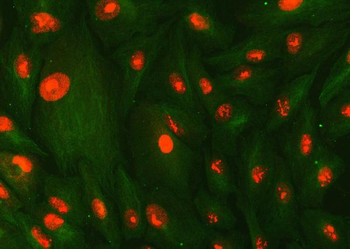 SMC1A Rabbit Polyclonal Antibody