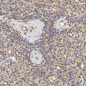 SNF2H/SMARCA5 Antibody