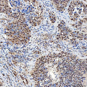 SNF2H/SMARCA5 Antibody