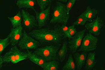 SNF2H/SMARCA5 Antibody