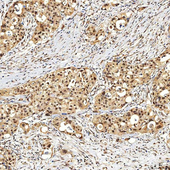 SNF2H/SMARCA5 Antibody