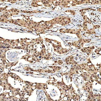 SNF2H/SMARCA5 Antibody