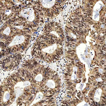 SNF2H/SMARCA5 Antibody