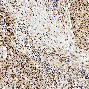 SNF2H/SMARCA5 Antibody