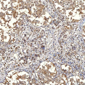 SNF2H/SMARCA5 Antibody