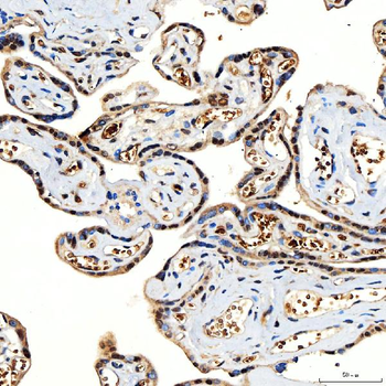 SNF2H/SMARCA5 Antibody