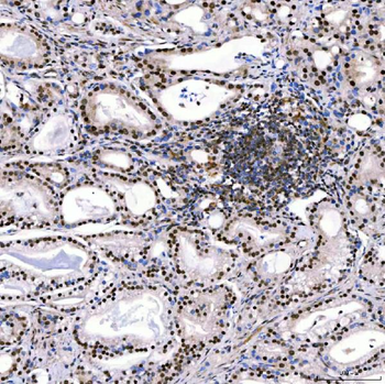 SMARCA2/BRM Antibody