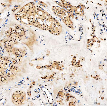 SMARCA2/BRM Antibody
