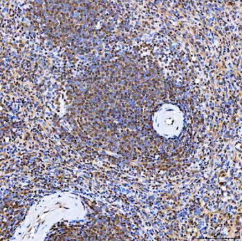 SMARCA2/BRM Antibody
